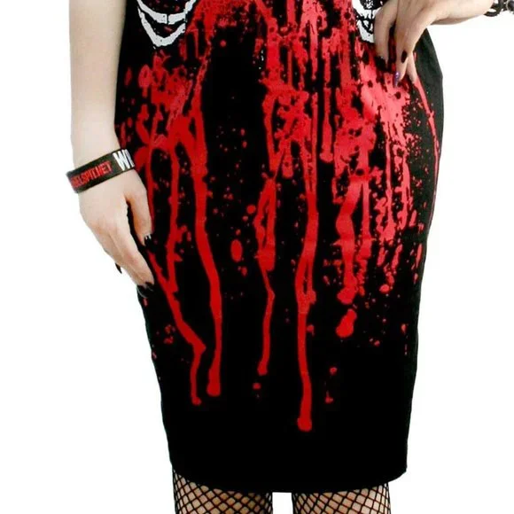 TOO FAST - BLEEDING RIBCAGE DRESS - Picture 3 of 8